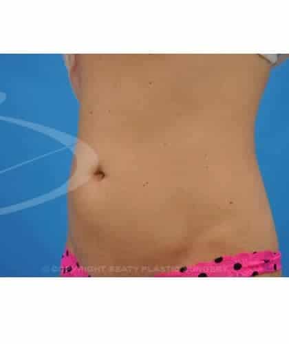 After Image