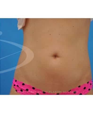 After Image