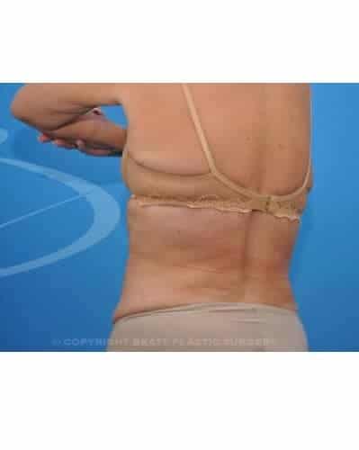 After Image