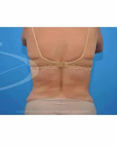 After Image