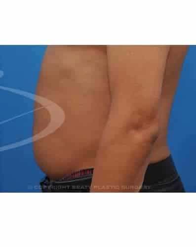 After Image