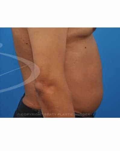 After Image