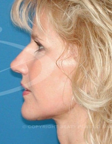 After Image