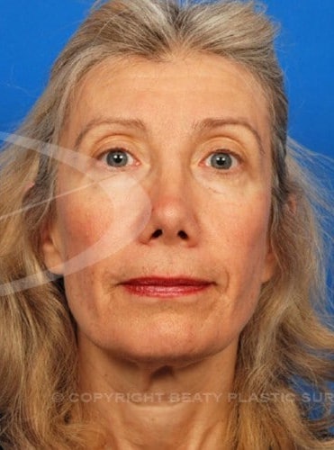 After Image