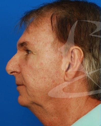 After Image