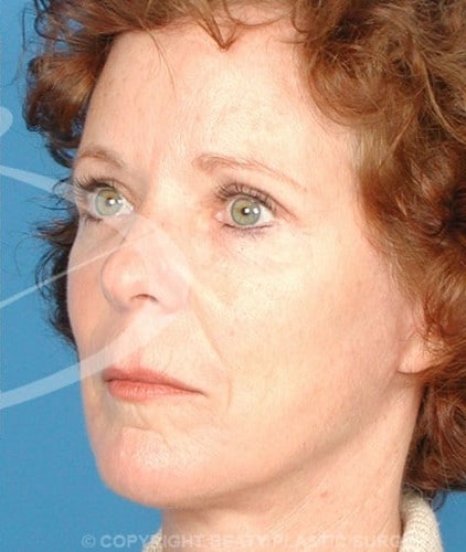 After Image