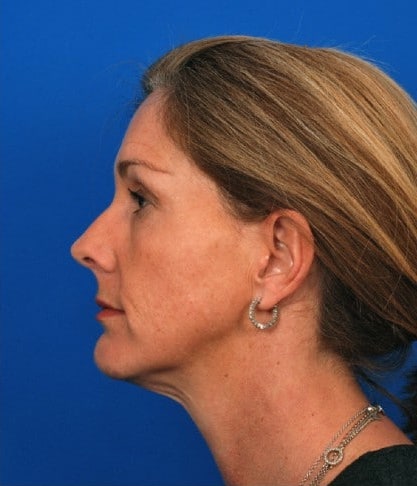 After Image