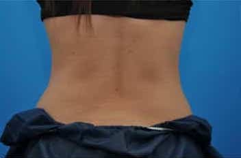 After Image