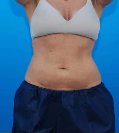 After Image