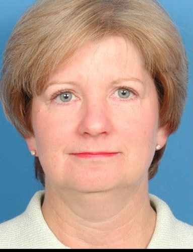 After Image