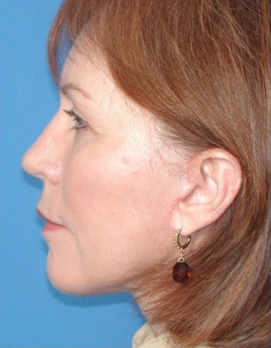 After Image