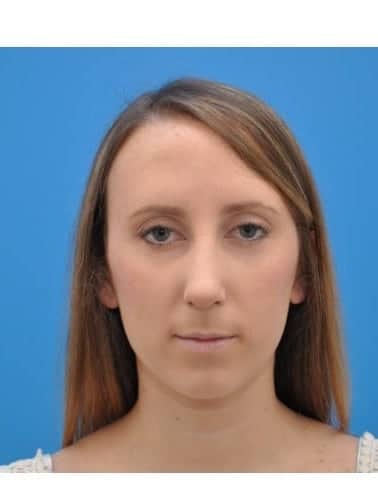 After Image