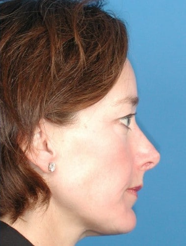 After Image