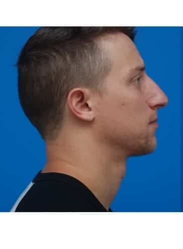 After Image