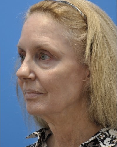 After Image
