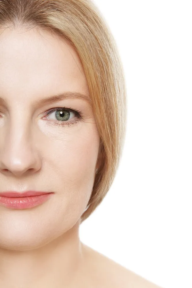 facelift