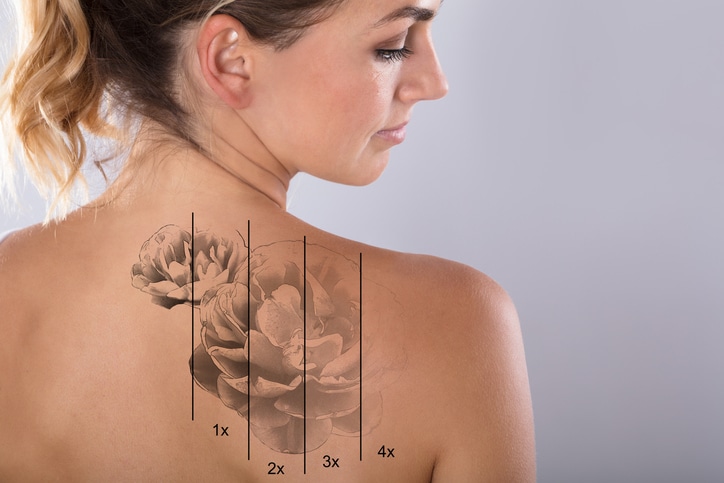 iStock 917893110