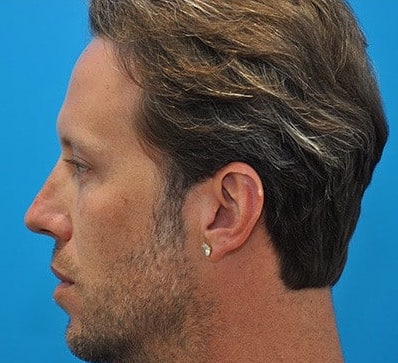 After Image