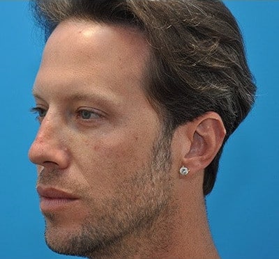 After Image