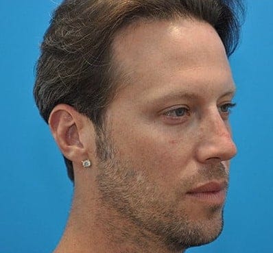 After Image