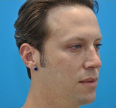 Before Image
