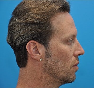 After Image