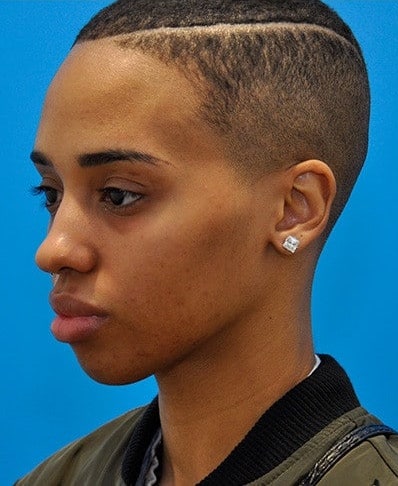 Before Image