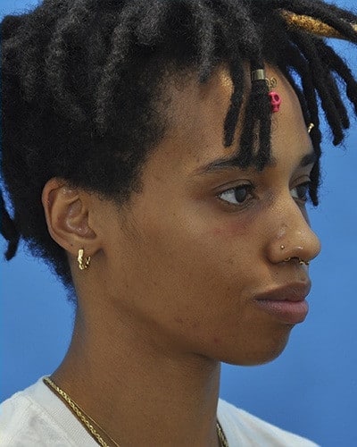 After Image
