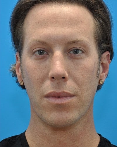After Image