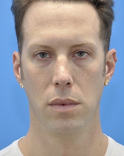 Before Image