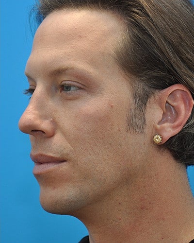 After Image