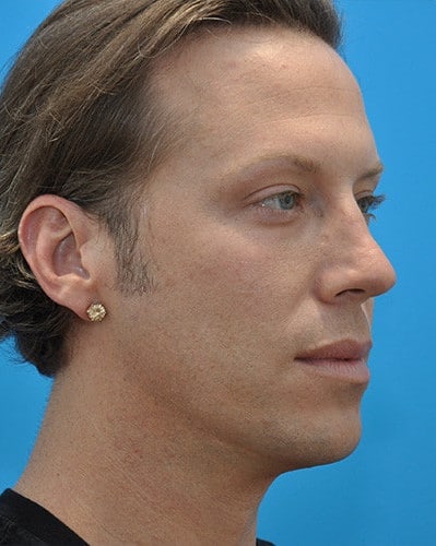 After Image