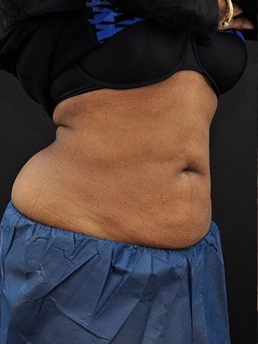 After Image