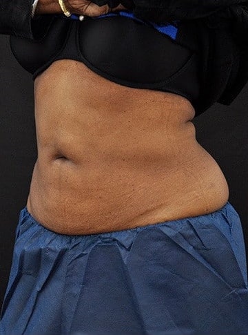 After Image