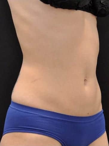 After Image