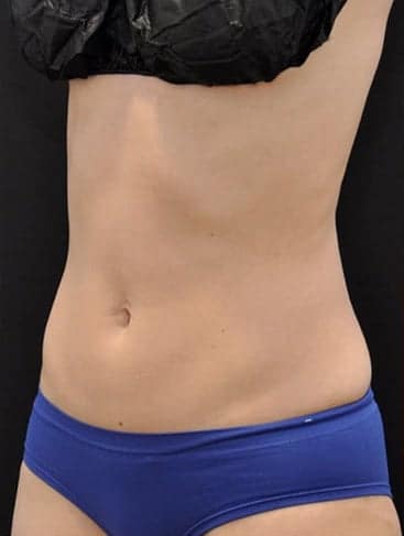 After Image