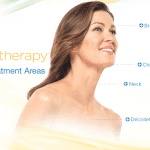 ultherapy model 150x150 1