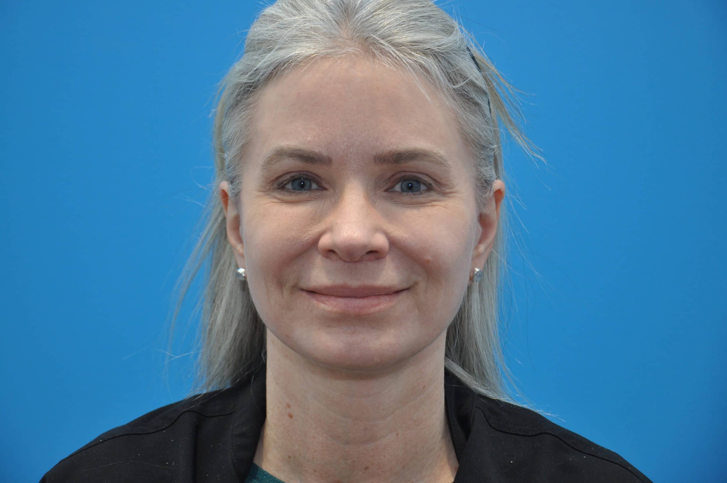 After Image