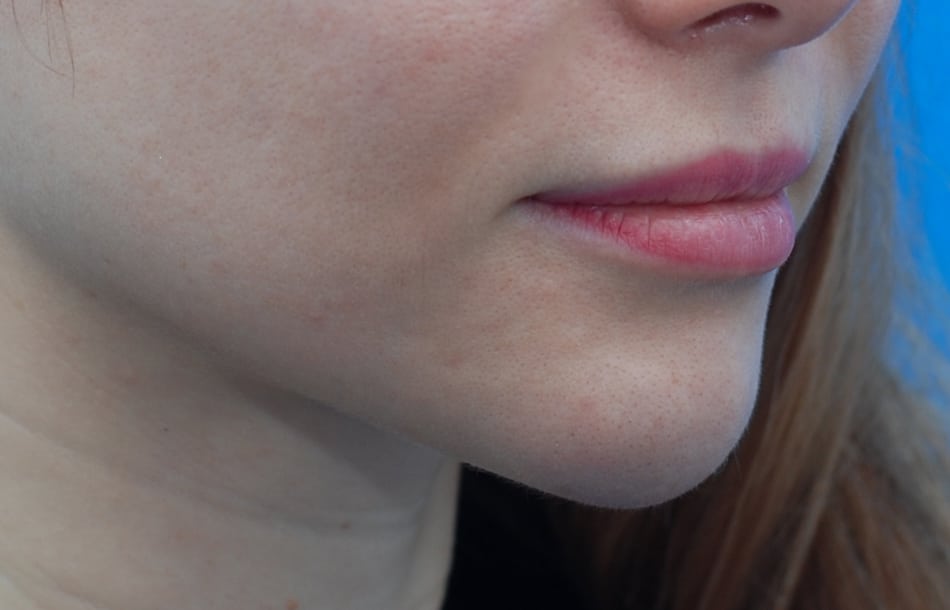 Before Image