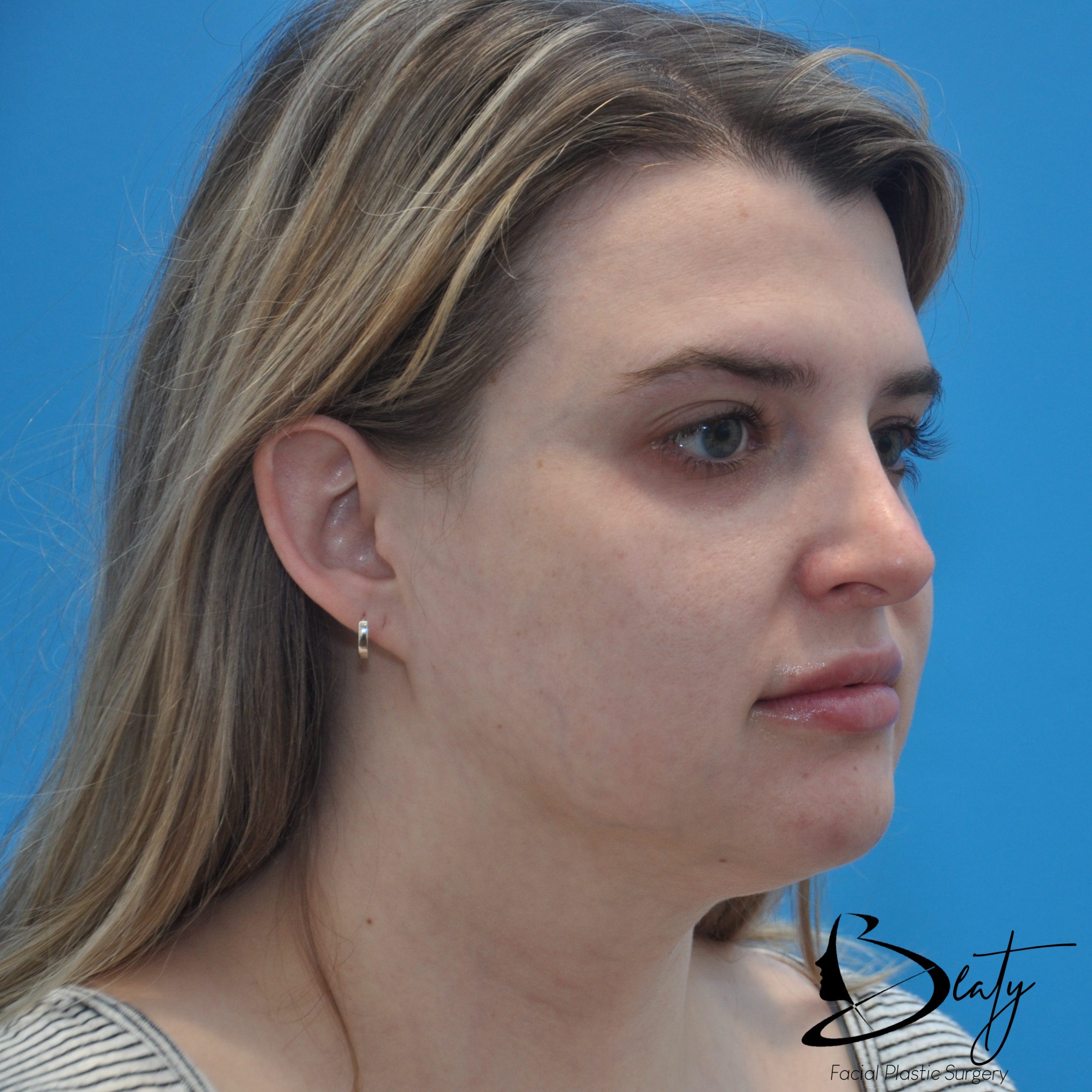 After Image