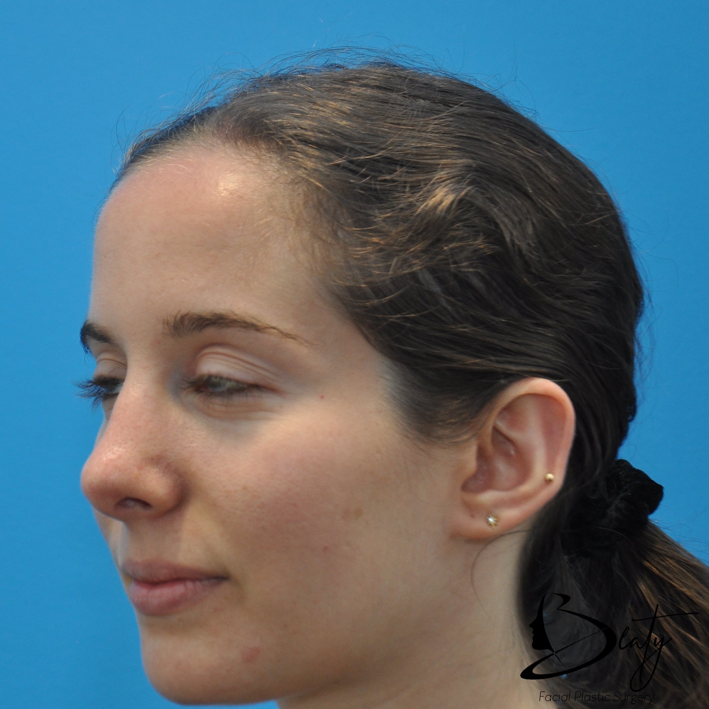 After Image