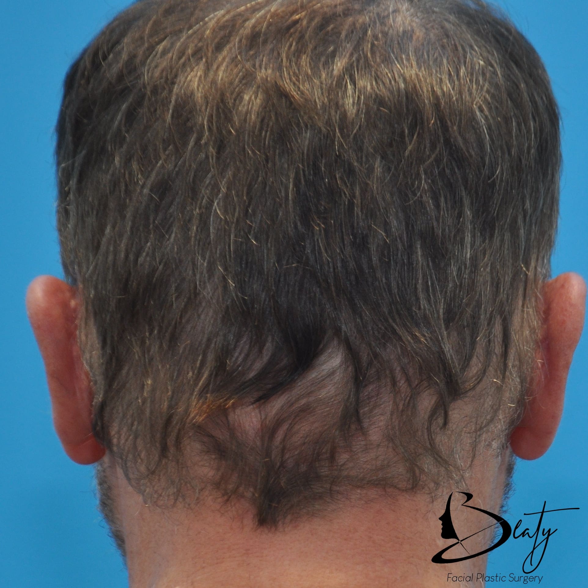 After Image