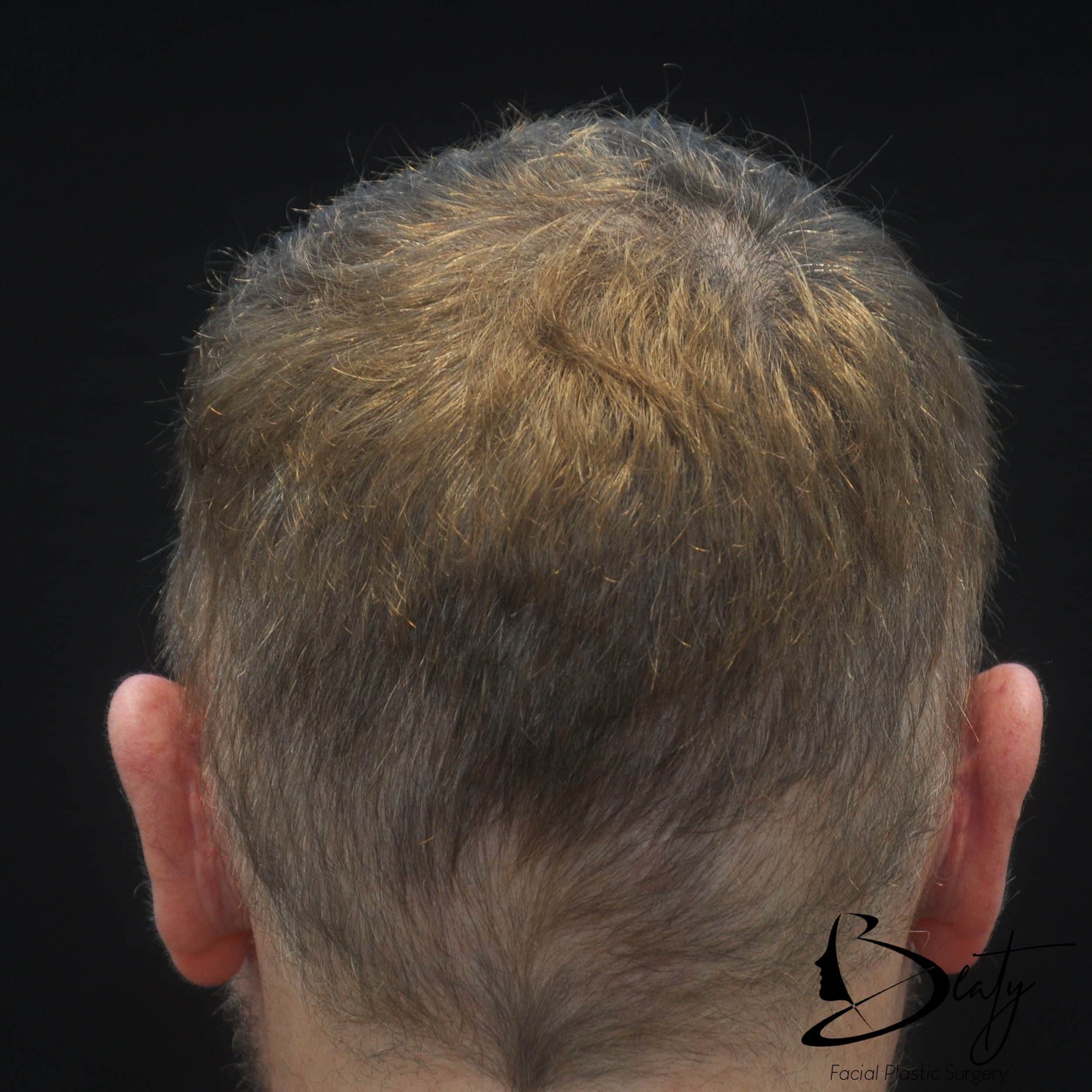 Before Image
