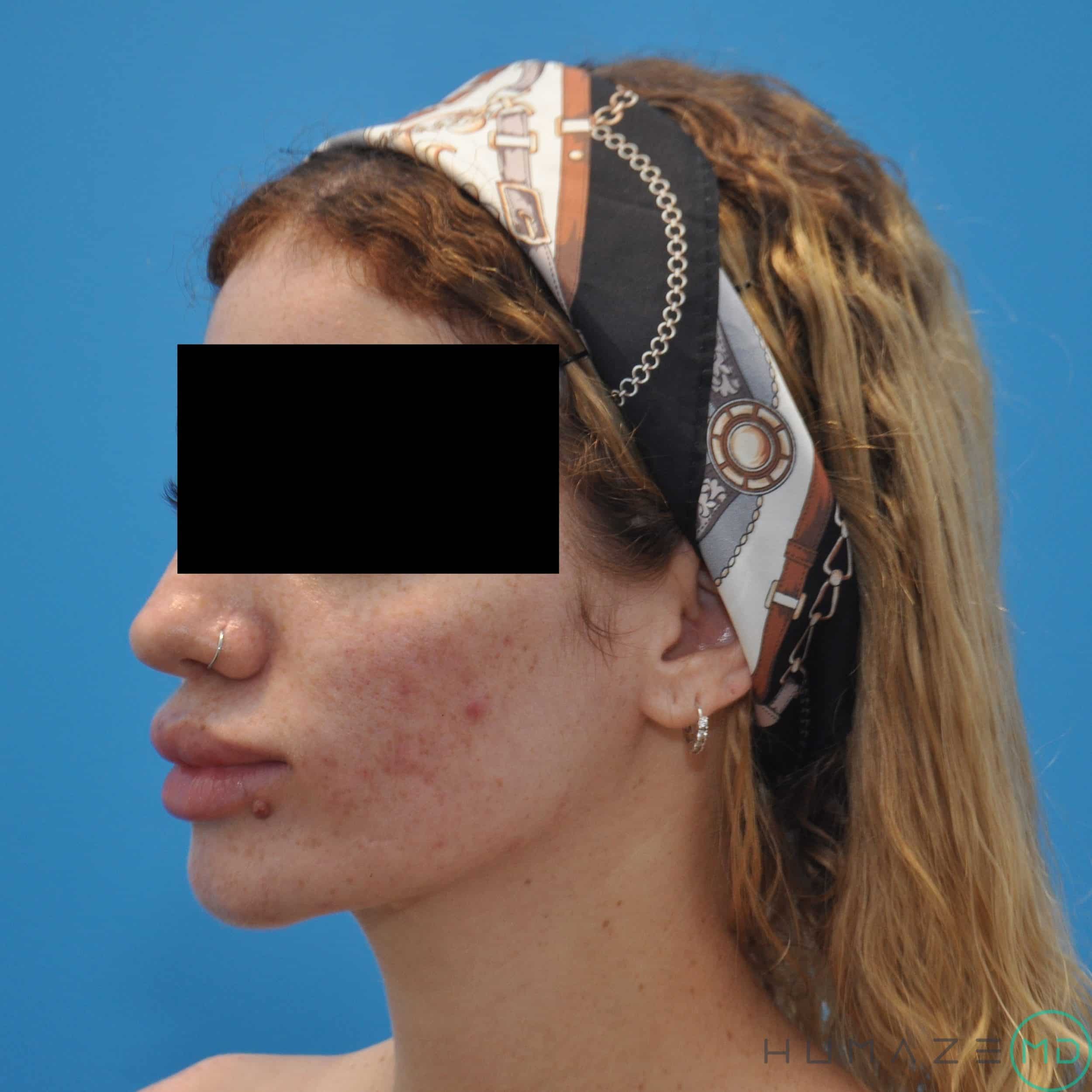 After Image
