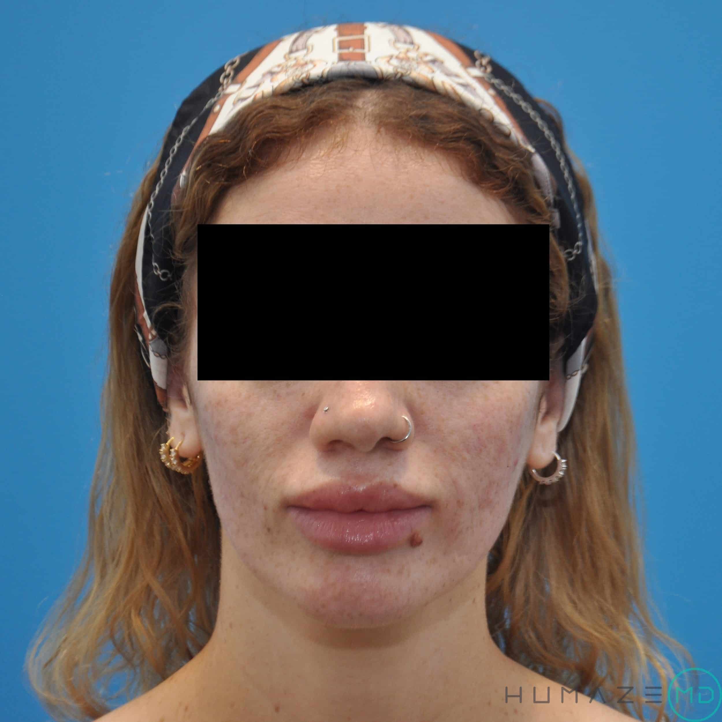After Image