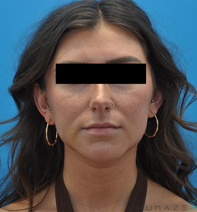 After Image