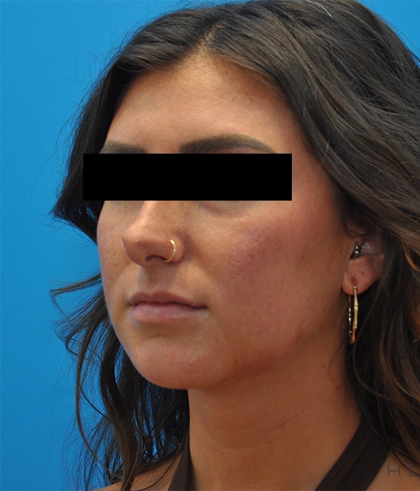 After Image