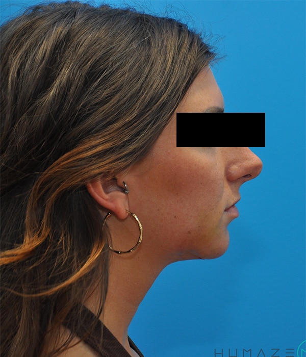 After Image