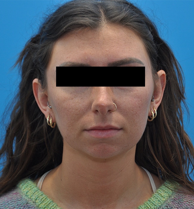 Before Image