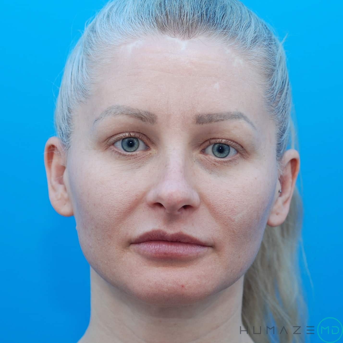 Before Image
